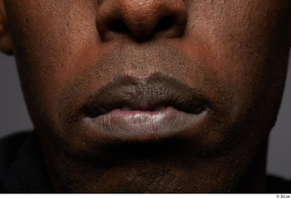  HD Face skin references Deqavious Reese lips mouth skin pores skin texture 0011.jpg
